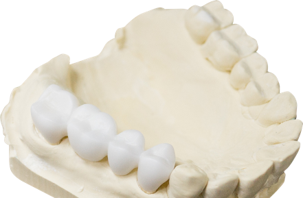 Моделирование зубных протезов